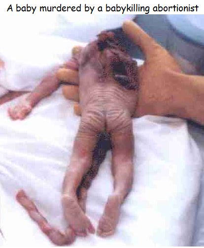 Paul Hill saves unborn babies 