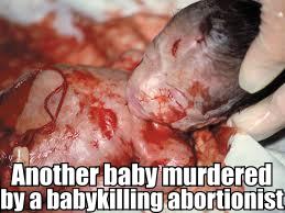 Baby killed by abortion